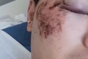 八字看生肖相害化解:在线测算易经八卦运势www.jixiangqiming.vip：-小伙梦游开窗跳楼，全身多处骨折，本人：醒来发现在空中